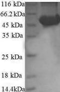 Recombinant Human Ribosomal protein S6 kinase beta-2 (RPS6KB2), partial – Figure 1 of 1