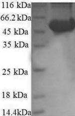 Recombinant Human Ribosomal protein S6 kinase beta-2 (RPS6KB2), partial – Figure 1 of 1