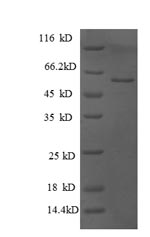 Recombinant Human Glucosidase 2 subunit beta (PRKCSH), partial – Figure 1 of 1