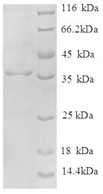 Recombinant Human NADH dehydrogenase [ubiquinone] 1 alpha subcomplex subunit 2 (NDUFA2), partial – Figure 1 of 1