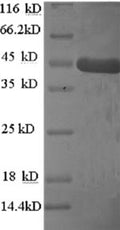 Recombinant Human Homer protein homolog 1 (HOMER1) – Figure 1 of 1