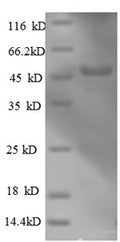 Recombinant Human Actin-related protein 2/3 complex subunit 3 (ARPC3), partial – Figure 1 of 1