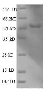Recombinant Human Actin-related protein 2/3 complex subunit 3 (ARPC3), partial – Figure 1 of 1