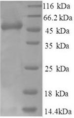 Recombinant Human Heterogeneous nuclear ribonucleoprotein Q (SYNCRIP), partial – Figure 1 of 1