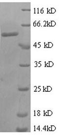 Recombinant Human Zinc finger protein 384 (ZNF384), partial – Figure 1 of 1