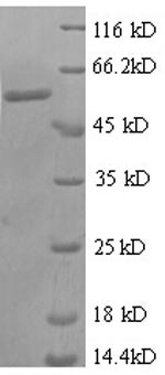 Recombinant Human Zinc finger protein 384 (ZNF384), partial – Figure 1 of 1