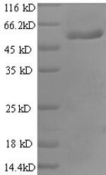 Recombinant Human Ras-related GTP-binding protein A (RRAGA), partial – Figure 1 of 1
