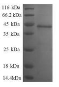 Recombinant Human Nuclear nucleic acid-binding protein C1D (C1D), partial – Figure 1 of 1