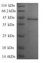 Recombinant Human Nuclear nucleic acid-binding protein C1D (C1D), partial – Figure 1 of 1
