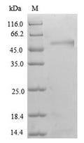 Recombinant Human Transcriptional adapter 3 (TADA3), partial – Figure 1 of 1