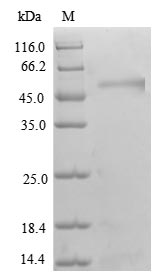 Recombinant Human Transcriptional adapter 3 (TADA3), partial – Figure 1 of 1