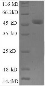 Recombinant Human Ubiquitin thioesterase OTUB1 (OTUB1), partial – Figure 1 of 1