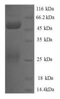 Recombinant Human Negative elongation factor B (NELFB), partial – Figure 1 of 1