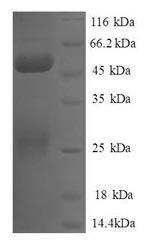Recombinant Human Negative elongation factor B (NELFB), partial – Figure 1 of 1