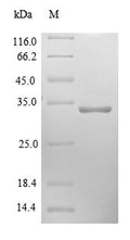 Recombinant Human Cytochrome b-c1 complex subunit 10 protein (UQCR11) – Figure 1 of 1