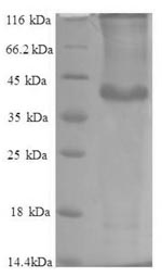 Recombinant Human Protein phosphatase 1 regulatory subunit 11 (PPP1R11) – Figure 1 of 1