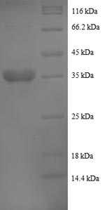Recombinant Human Cytochrome b-c1 complex subunit 8 (UQCRQ), partial – Figure 1 of 1