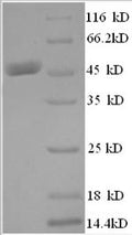 Recombinant Human Histone acetyltransferase KAT7 (KAT7), partial – Figure 1 of 1