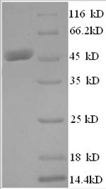 Recombinant Human Histone acetyltransferase KAT7 (KAT7), partial – Figure 1 of 1