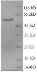 (Tris-Glycine gel) Discontinuous SDS-PAGE (reduced) with 5% enrichment gel and 15% separation gel.