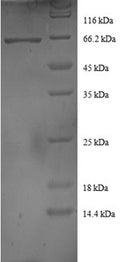 Recombinant Human DnaJ homolog subfamily B member 1 (DNAJB1) – Figure 1 of 1
