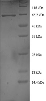 Recombinant Human DnaJ homolog subfamily B member 1 (DNAJB1) – Figure 1 of 1