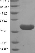 Recombinant Human G-protein coupled receptor 161 (GPR161), partial – Figure 1 of 1