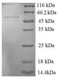 (Tris-Glycine gel) Discontinuous SDS-PAGE (reduced) with 5% enrichment gel and 15% separation gel.