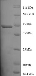 (Tris-Glycine gel) Discontinuous SDS-PAGE (reduced) with 5% enrichment gel and 15% separation gel.