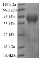 Recombinant Human 60S ribosomal protein L35 (RPL35) – Figure 1 of 1