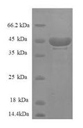 Recombinant Human 40S ribosomal protein S14 (RPS14), partial – Figure 1 of 1