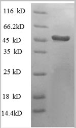 (Tris-Glycine gel) Discontinuous SDS-PAGE (reduced) with 5% enrichment gel and 15% separation gel.