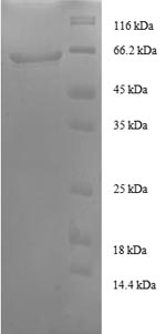 Recombinant Human Transaldolase (TALDO1), partial – Figure 1 of 1