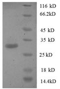 Recombinant Human Phosphatidylserine synthase 1 (PTDSS1), partial – Figure 1 of 1