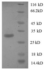 Recombinant Human Phosphatidylserine synthase 1 (PTDSS1), partial – Figure 1 of 1