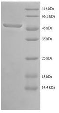 Recombinant Human Tyrosine-protein kinase ABL1 (ABL1), partial – Figure 1 of 1