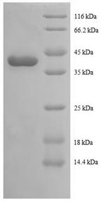Recombinant Human Tax1-binding protein 3 (TAX1BP3) – Figure 1 of 1