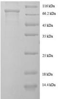 Recombinant Human EF-hand domain-containing protein KIAA0494 (KIAA0494), partial – Figure 1 of 1