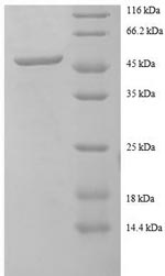 Recombinant Human Charged multivesicular body protein 2a (CHMP2A) – Figure 1 of 1