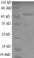 Recombinant Human Cytochrome b-c1 complex subunit Rieske, mitochondrial (UQCRFS1) – Figure 1 of 1