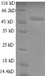 Recombinant Human Cytochrome b-c1 complex subunit Rieske, mitochondrial (UQCRFS1) – Figure 1 of 1