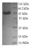 Recombinant Human Transmembrane emp24 domain-containing protein 9 (GP25L2), partial – Figure 1 of 1