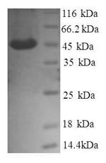 Recombinant Human Transmembrane emp24 domain-containing protein 9 (GP25L2), partial – Figure 1 of 1