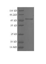 Recombinant Human Breast cancer metastasis-suppressor 1 (BRMS1), partial – Figure 1 of 1