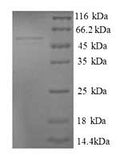 Recombinant Human 39S ribosomal protein L9, mitochondrial (MRPL9) – Figure 1 of 1