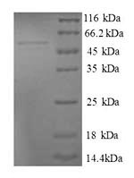 Recombinant Human 39S ribosomal protein L9, mitochondrial (MRPL9) – Figure 1 of 1