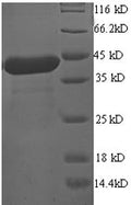 (Tris-Glycine gel) Discontinuous SDS-PAGE (reduced) with 5% enrichment gel and 15% separation gel.
