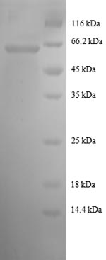 Recombinant Human Malate dehydrogenase, Cytoplasmic (MDH1), partial – Figure 1 of 1