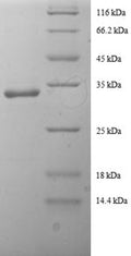 Recombinant Human Tricarboxylate transport protein (SLC20A3), partial – Figure 1 of 1