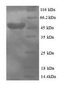 Recombinant Human Protein canopy homolog 2 (CNPY2) – Figure 1 of 1
